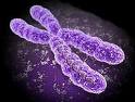 Syndromes of chromosome 14 defects